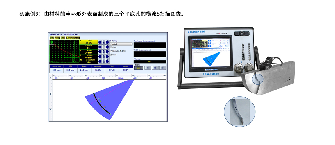 B扫描9.jpg